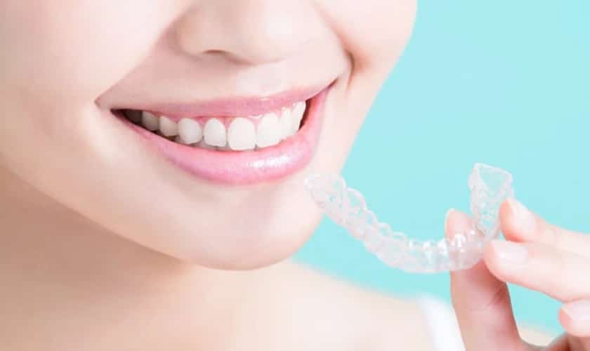 How To Maintain Proper Oral Hygiene With Clear Braces In Ann Arbor, MI